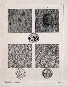 Several examples of skin disease. Lithograph by W. Walton after Franz Bauer.