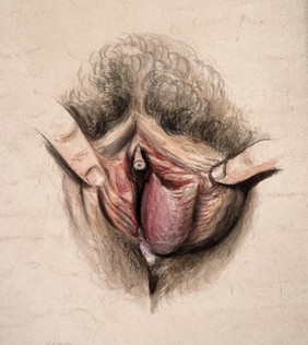 Female genitalia held open by two fingers to show an area of diseased tissue. Watercolour by Christopher D' Alton, 1857.