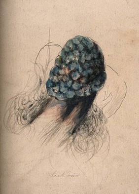 A severely diseased penis. Watercolour by C. D'Alton, 1840/1870?.