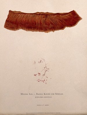 view A stomach showing signs of cholera asiatica, with a detail below showing bacteria cells as seen under a microscope. Chromolithograph by W. Gummelt, ca. 1897.