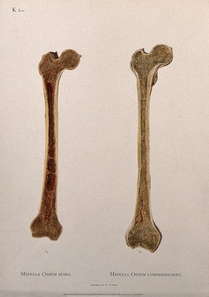 view Sections through two femur bones: the left illustration indicating the red bone marrow, the right showing the marrow and lymphatics. Chromolithograph by W. Gummelt, ca. 1897.