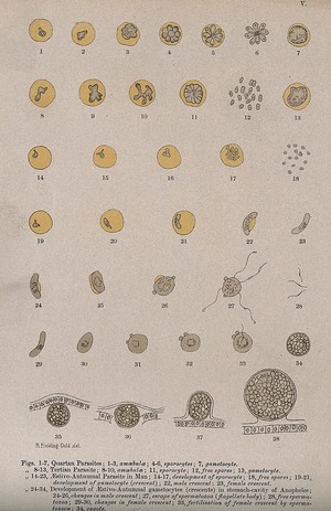 view Malaria parasites seen through a microscope. Colour lithograph after R. Fielding-Ould, ca. 1905.