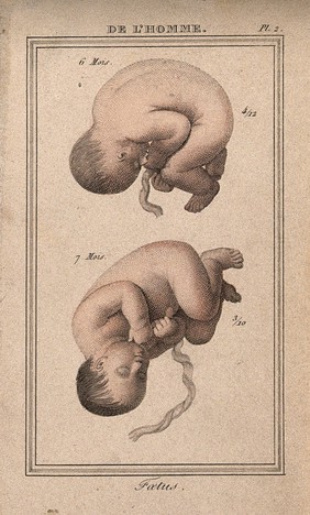 A foetus shown at six and at seven months. Coloured engraving, 1818.