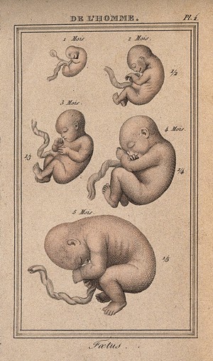 view A foetus shown at various stages of development, from one month to five months. Coloured engraving, 1818.