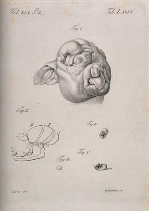 view The head of a baby (?), enclosed within the skin of a pig's head, with details showing bones and organs (?). Stipple engraving by Gottschick after Carus, ca. 1820.