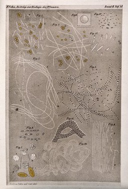 The anthrax bacillus: ten examples, as seen through a microscope. Colour photograph, ca. 1948, after A. Assmann, ca. 1876, after R. Koch and F. Cohn, ca. 1876.