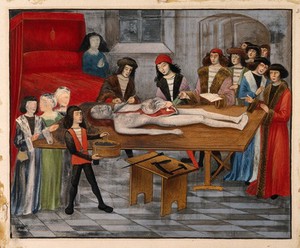 view Post-mortem of a woman. Gouache painting, after a fifteenth-century manuscript illustration.