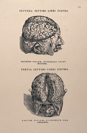 view The brains of dissected heads. Photolithograph, 1940, after a woodcut, 1543.