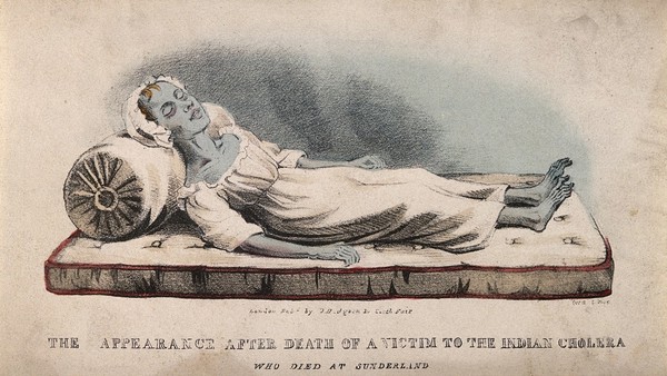 A dead victim of cholera at Sunderland in 1832. Coloured lithograph attributed to J.W. Gear.