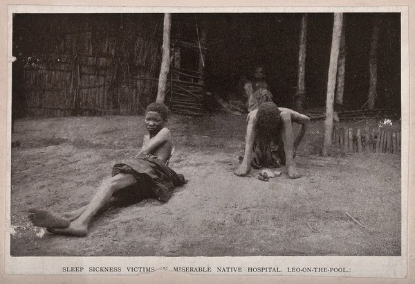 Two victims of sleeping sickness. Reproduction of a photograph.