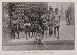 view A group of children suffering from sleeping sickness. Reproduction of a photograph.