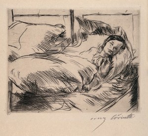 view A sick child (Das Kranke Kind). Drypoint by L. Corinth, 1918.