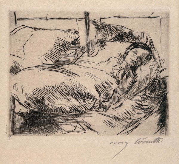 A sick child (Das Kranke Kind). Drypoint by L. Corinth, 1918.