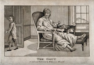 view A disgruntled gouty man ringing a bell for his servant who is just leaving the room. Etching.