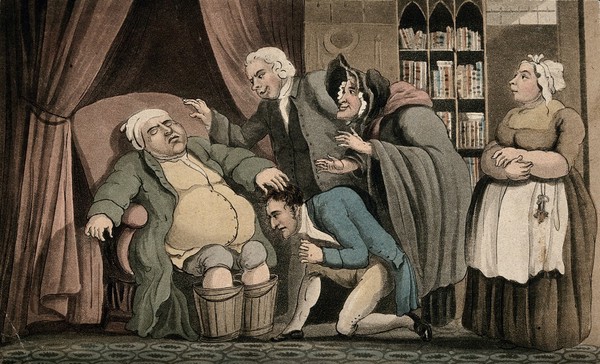 An obese gouty man with his feet in buckets. Coloured aquatint.