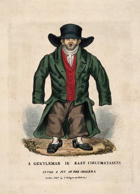 A man who has lost weight due to cholera: his clothes are now too large. Coloured lithograph.