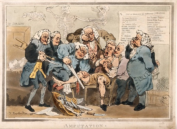 Five surgeons participating in the amputation of a man's leg while another oversees them. Coloured aquatint by T. Rowlandson, 1793.
