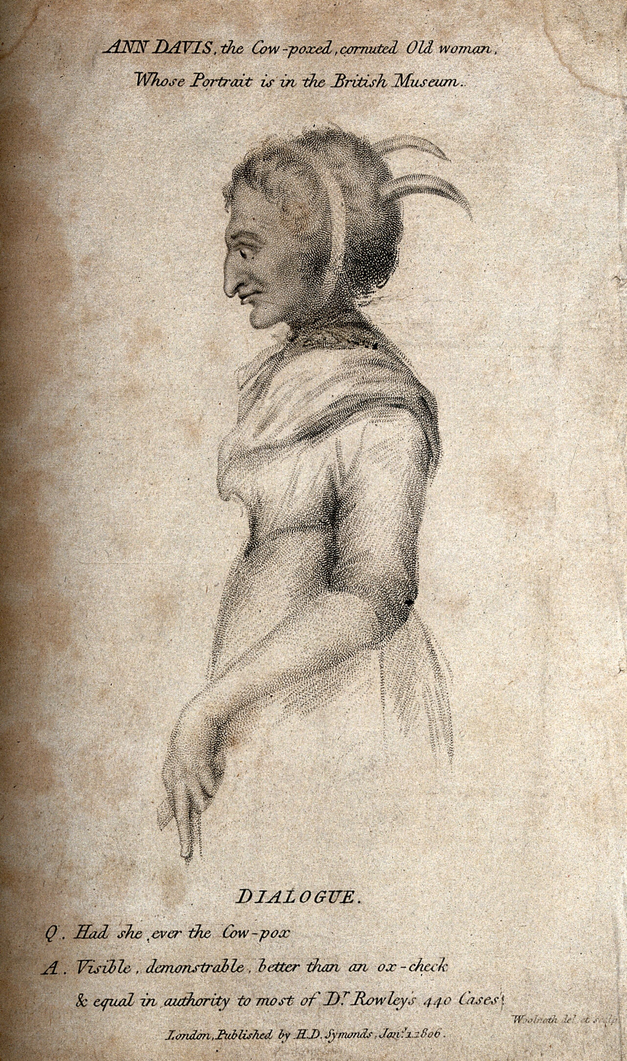 Ann Davis, a woman with smallpox and horns growing out of her head. Stipple engraving by T. Woolnoth, 1806., 1 January 1806, by Thomas Woolnoth