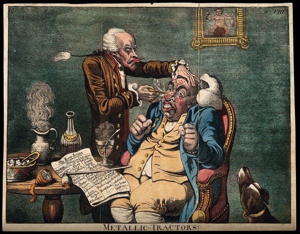 An operator treating the carbuncled nose of an obese patient with "Perkins's tractors". Coloured aquatint after J. Gillray, 1801.