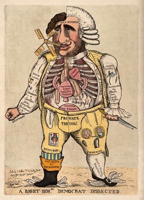 A vertical anatomical bisection of Charles James Fox, one half of him dressed as a Frenchman, and the other half an Englishman. Coloured etching by W. Dent, 1793.