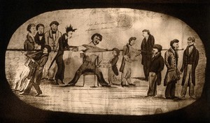 view Royal Infirmary of Edinburgh: doctors treating a patient with a dislocated shoulder, ca. 182-. Photograph, 1927, after Johnston, 182-.