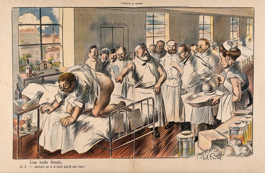 Surgeons group around a patient exhibiting an especially dramatic anal fistula; the patient happily thinks to himself that he has never before been the object of such attention. Colour process print after J-A. Faivre, 1902.