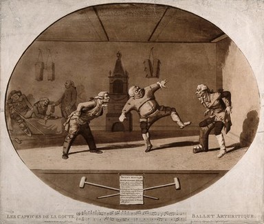 Three men wearing orthopedic apparatus exercising; another is strapped into leg braces. Aquatint by P. Sandby (?), 1783.