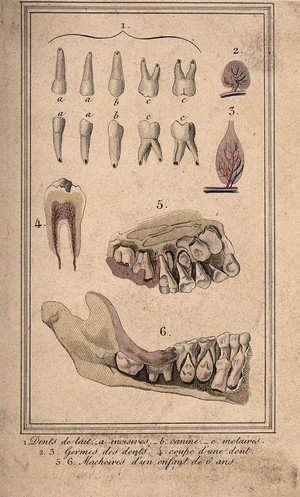 view Diagrams of incisors, canines and molars, a diseased tooth and the jaw of a six year old showing the adult teeth about to erupt below the milk teeth. Coloured engraving by A. Tardieu(?).
