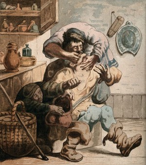 view A tooth-drawer extracting a tooth from a seated patient while a woman steals from his bag. Watercolour after J.J. van Vliet.