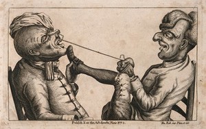 view A tooth-drawer using a cord to extract a tooth from an agonized patient. Etching by J. Collier, 1773.