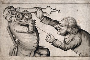 view A tooth-drawer frightening his patient with a hot coal causing him to pull away violently and extract a tooth. Pen drawing after J. Collier, 1773.