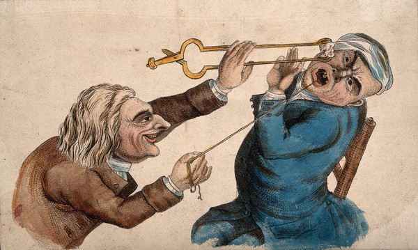 A tooth-drawer frightening his patient with a hot coal causing him to pull away violently and extract a tooth. Coloured etching, 1810, after J. Collier.