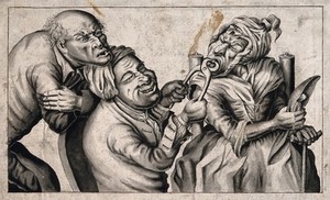 view A tooth-drawer using pincers to extract a tooth from an old woman, her husband agonizingly observes the situation. Pen drawing after J. Collier, 1773.