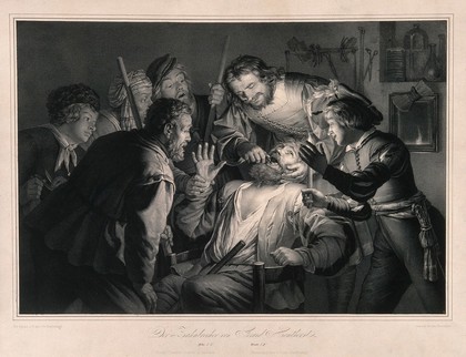 A tooth-drawer in his practice extracting a tooth from a seated patient who is surrounded by friends and family holding candles. Lithograph by F. Hanfstaengl after G. van Honthorst.