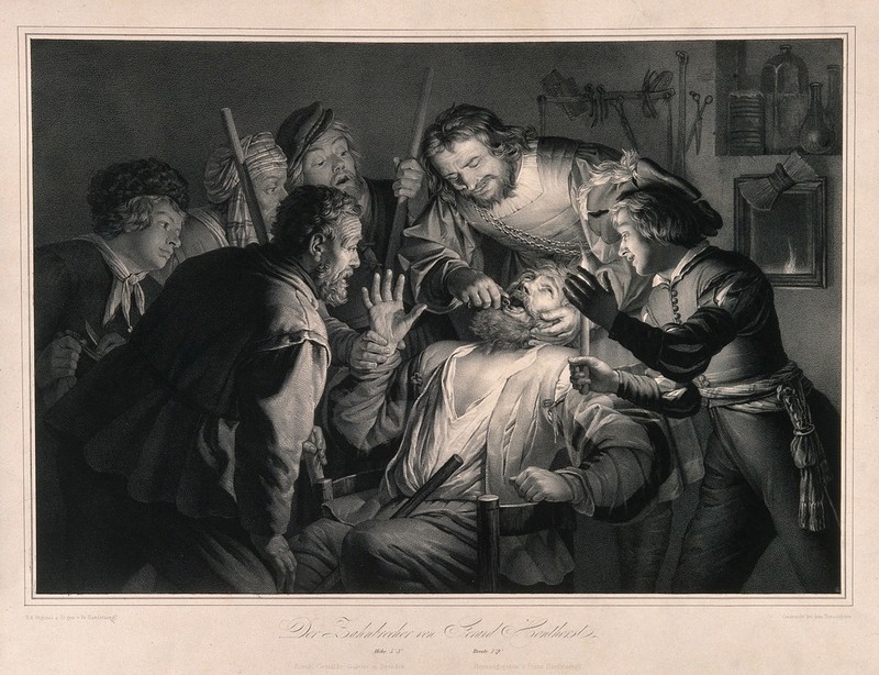 A tooth-drawer in his practice extracting a tooth from a A tooth-drawer in his practice extracting a tooth from a