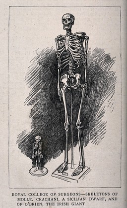 Skeletons of a male giant and a female dwarf, displayed at the Royal College of Surgeons. Process print.