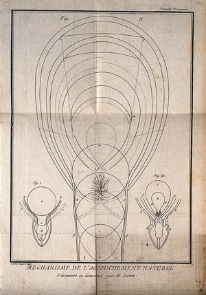 view Three interior diagrams of an adult human uterus. Etching by G. Scotin.