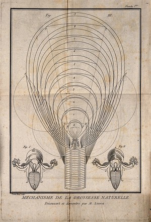 view Three interior diagrams of a human uterus. Etching by G. Scotin.