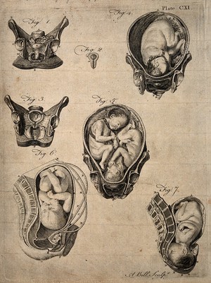 view Cross-sections of seven different figures of the pregnant uterus. Engraving by A. Bell.