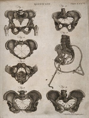 view Seven diagrams of differently shaped pelvises and their measurements. Engraving by A. Bell.