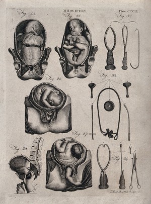 view Eight diagrams illustrating difficult births and obstetrical instruments. Engraving by A. Bell.