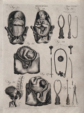 Eight diagrams illustrating difficult births and obstetrical instruments. Engraving by A. Bell.