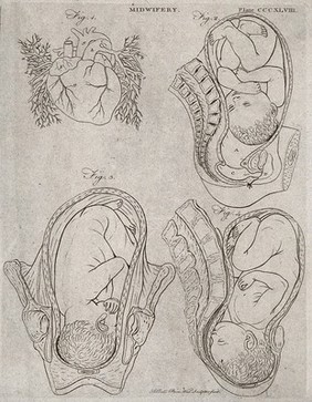 A diagram of the heart and three illustrations of babies in the womb. Engraving by A. Bell.