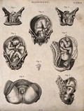 view Eight diagrams illustrating babies in the womb and internal structures of the womb. Etching by Barlow.