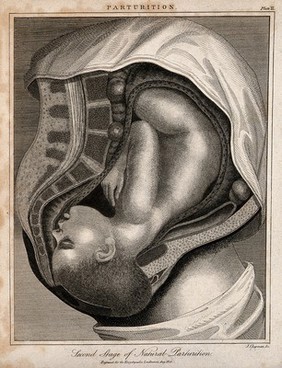 A cross-section of a pregnant woman's body in the final stages of labour. Engraving by J. Chapman, 1821.