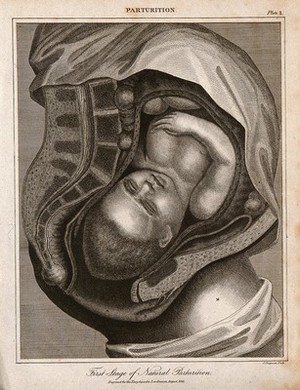 view A cross-section of a pregnant woman's body just before she gives birth. Engraving by J. Chapman, 1821.