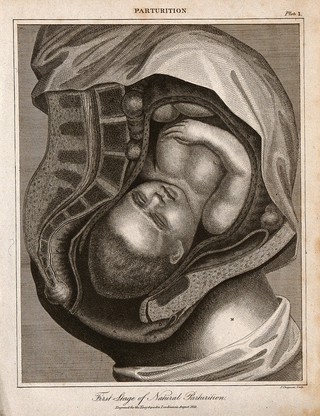 A cross-section of a pregnant woman's body just before she gives birth. Engraving by J. Chapman, 1821.