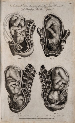 view Four diagrams of babies in the womb. Engraving by W. Taylor, 1791, after F. Birnie after W. Smellie.