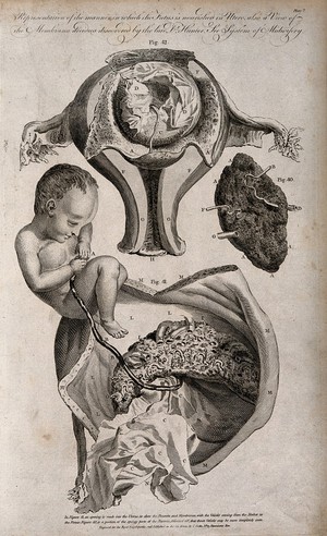 view A cross-section of a uterus illustrating how the foetus is fed internally by the mother. Engraving by W. Taylor, 1791, after F. Birnie after W. Smellie.