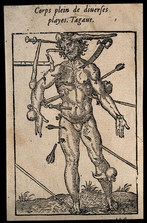 view Wound man showing all the weapons and points of injury. Woodcut.